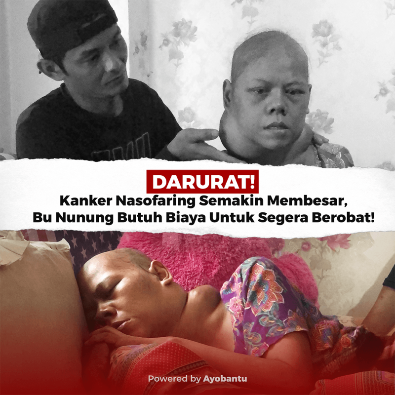 DARURAT! Kanker Nasofaring Semakin Membesar, Bu Nunung Butuh Biaya Untuk Segera Berobat!