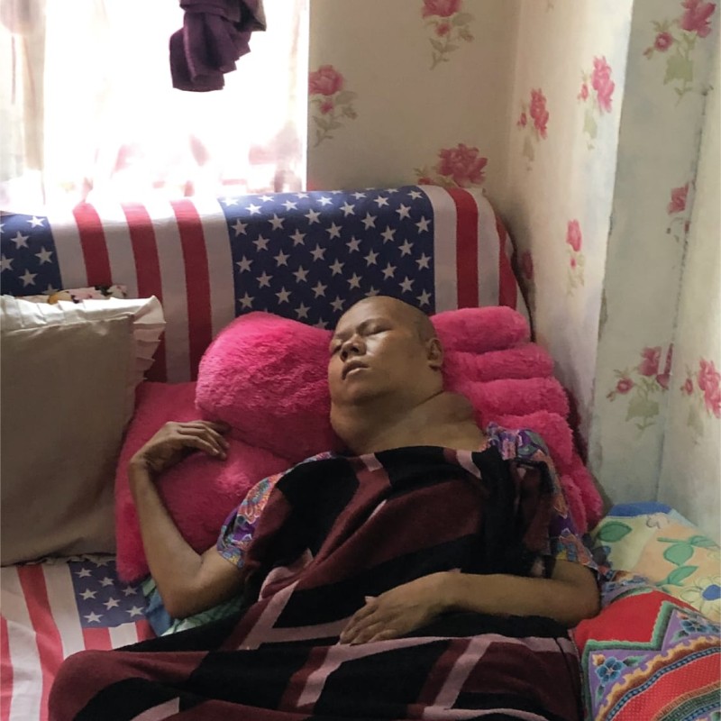DARURAT! Kanker Nasofaring Semakin Membesar, Bu Nunung Butuh Biaya Untuk Segera Berobat!