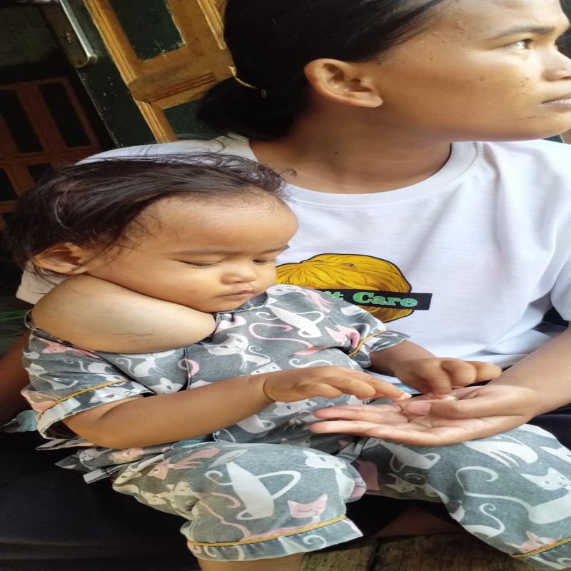 Benjolan di leher terus Membesar, Adik Ziya harus segera Operasi