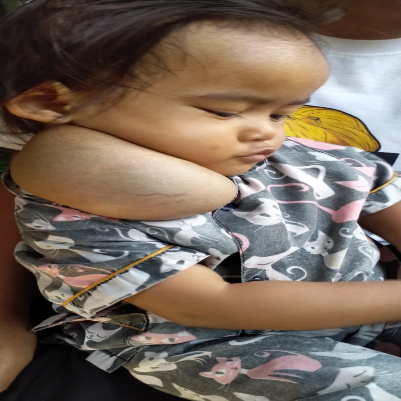 Benjolan di leher terus Membesar, Adik Ziya harus segera Operasi