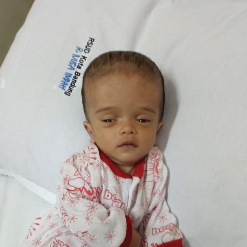 Bertahun-tahun Dek Rasya Berjuang Dengan Penyakit Hydrocephalus. Mari Kita Bantu!