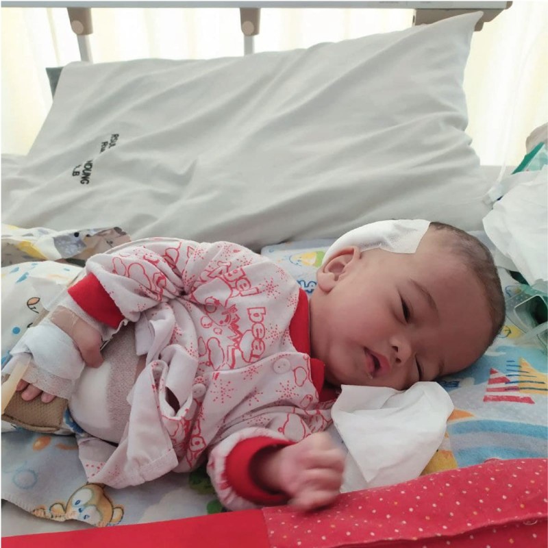 Bertahun-tahun Dek Rasya Berjuang Dengan Penyakit Hydrocephalus. Mari Kita Bantu!
