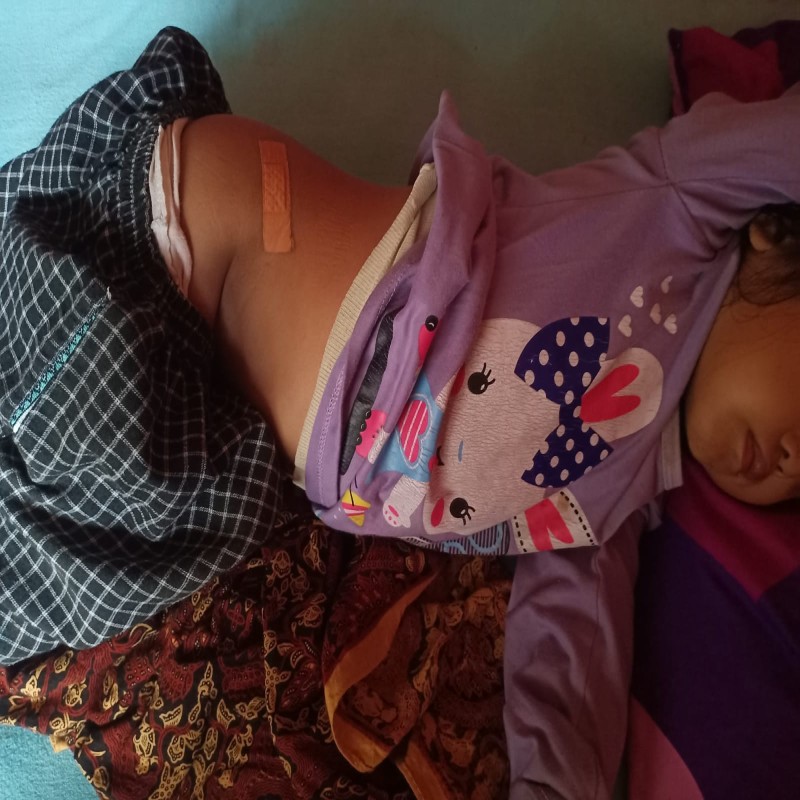 BANTU ANIS 4 TH SEMBUH DARI KANKER SEL-SEL DARAH