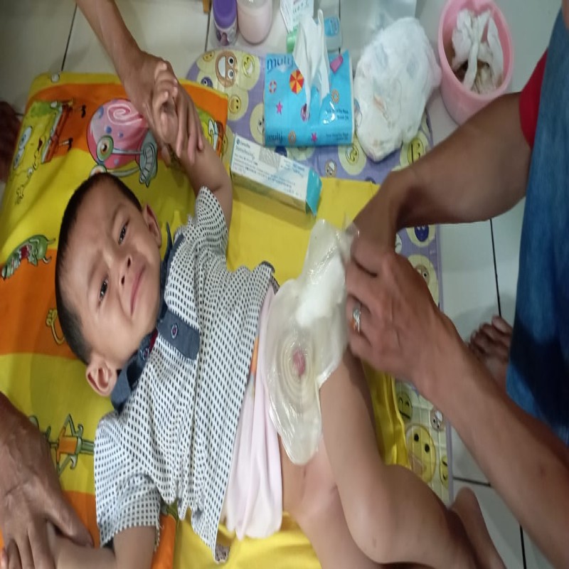 DITINGGAL IBU SEJAK LAHIR, BAYI RANDIANSAH USUSNYA KELUAR  DAN PERLU OPERASI