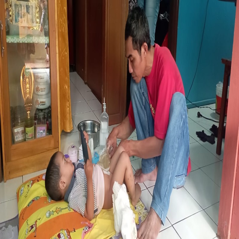 DITINGGAL IBU SEJAK LAHIR, BAYI RANDIANSAH USUSNYA KELUAR  DAN PERLU OPERASI