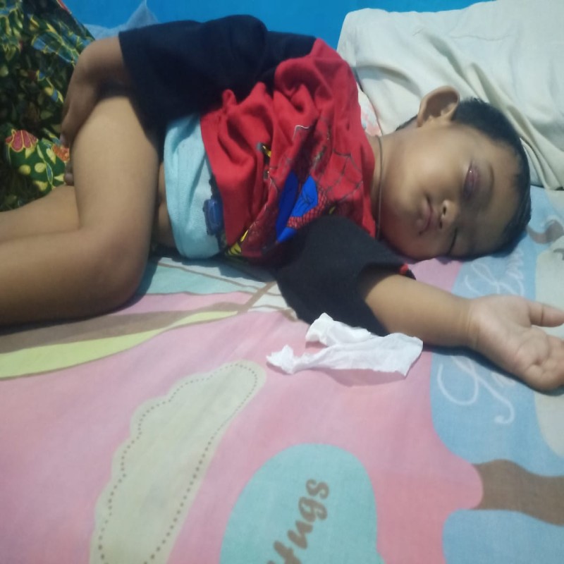 BANTU ZULFIKAR KANKER MATA