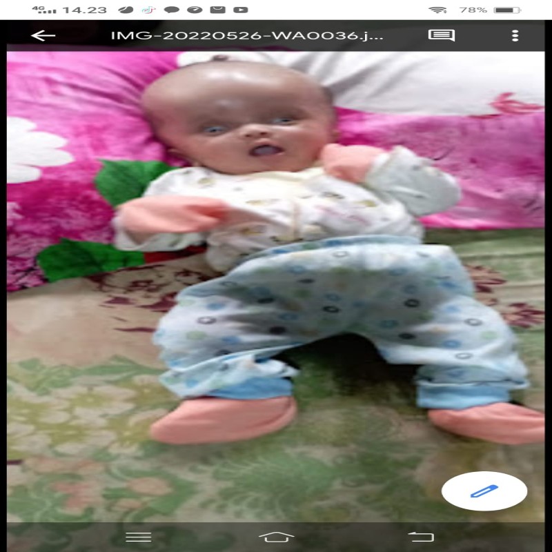 URGENT!! KEPALA MEMBESAR BAYI SYAKILA HARUS SEGERA OPERASI