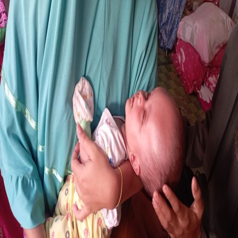 URGENT!! KEPALA MEMBESAR BAYI SYAKILA HARUS SEGERA OPERASI