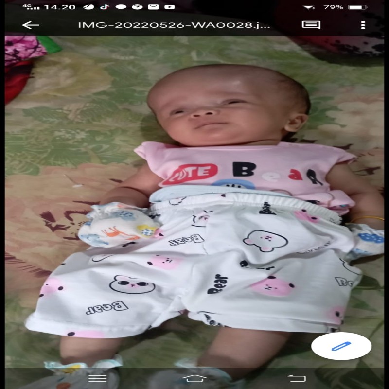 URGENT!! KEPALA MEMBESAR BAYI SYAKILA HARUS SEGERA OPERASI