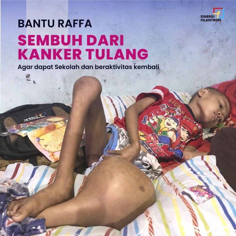 Urgent! Kanker Tulang Raffa Semakin Parah