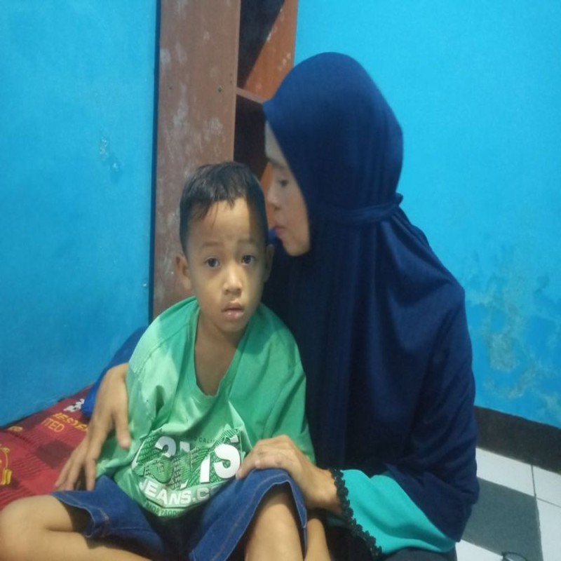 RADIT 7 TAHUN IDAP LUKA BAKAR DAN BERUBAH MENJADI KANKER