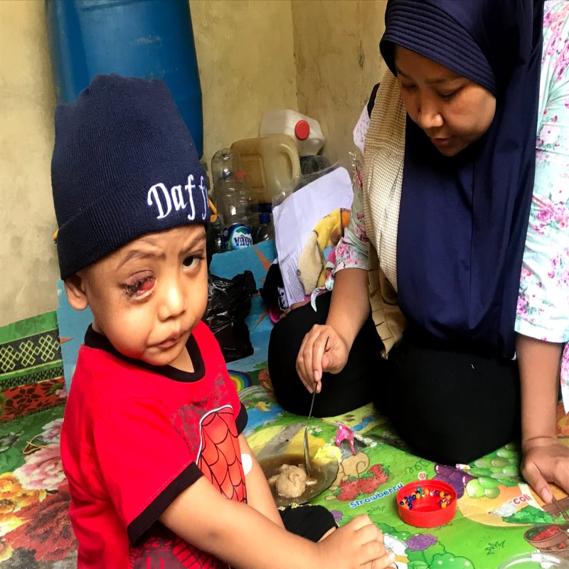 DAFFA 3 TAHUN IDAP KANKER MATA