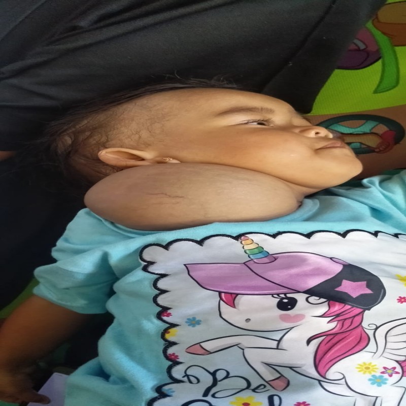 BANTU ADIK ZIYA OPERASI BENJOLAN DI LEHER SEMAKIN MEMBESAR