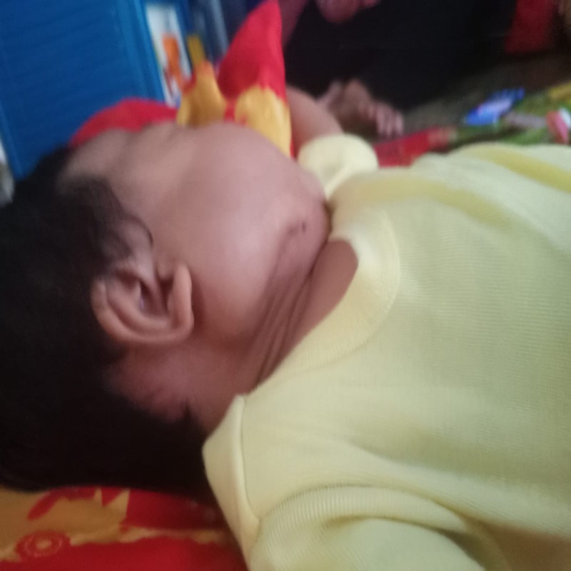 BANTU BAYI MISHAL OPERASI LEHER SEMAKIN MEMBESAR
