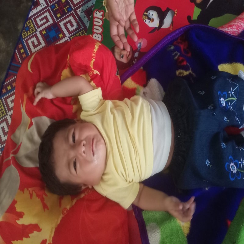 BANTU BAYI MISHAL OPERASI LEHER SEMAKIN MEMBESAR