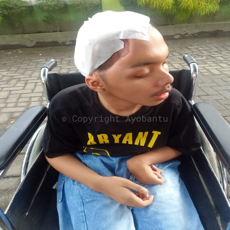 Fajah Masih Terus Bertahan denan Sebelah Tempurung Kepala, Bantu Perjuangan Fajah