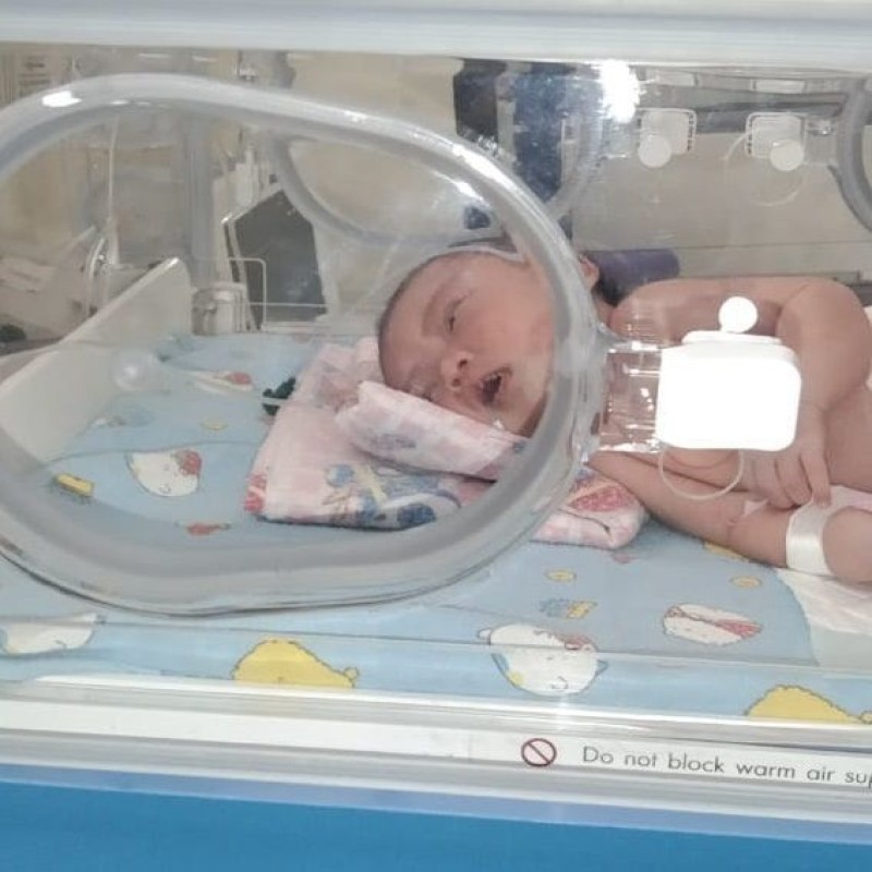 BAYI NURUL ANAK KULI IDAP PENYAKIT LANGKA