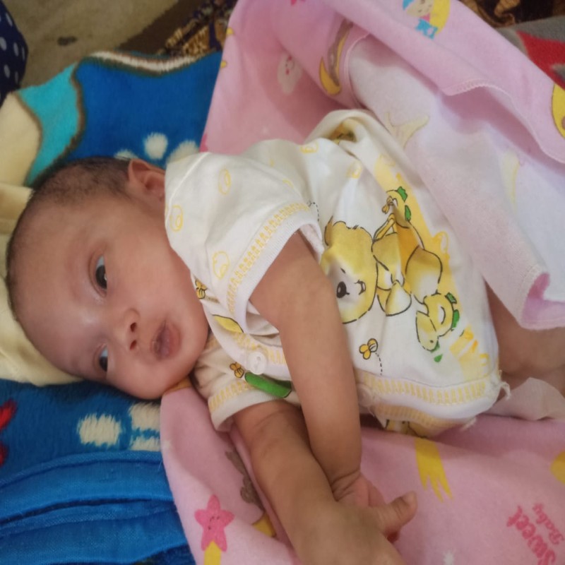 BAYI NURUL ANAK KULI IDAP PENYAKIT LANGKA