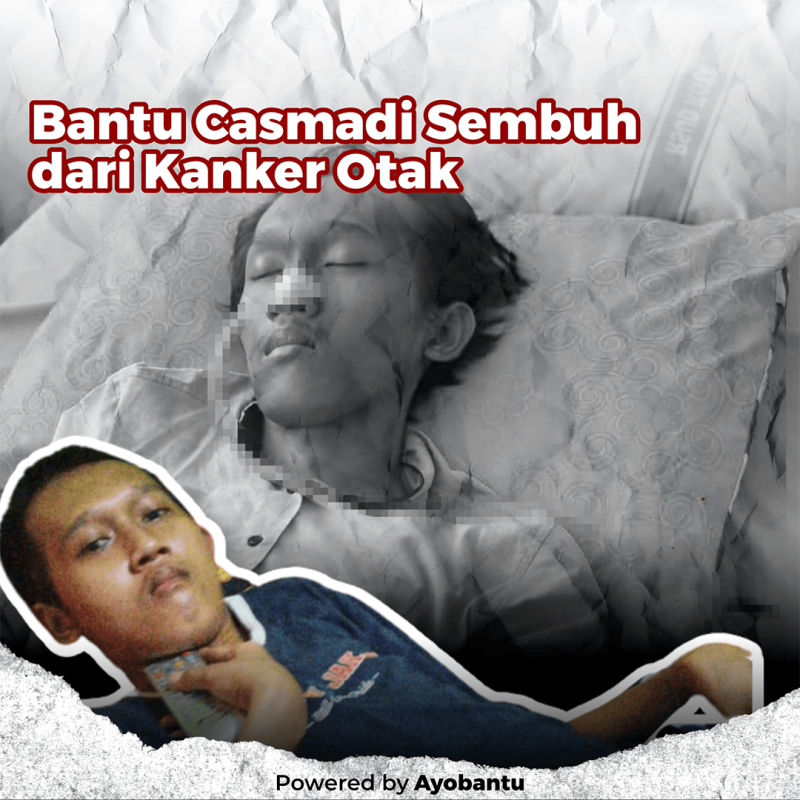 Bantu Casmadi Sembuh dari Kanker Otak