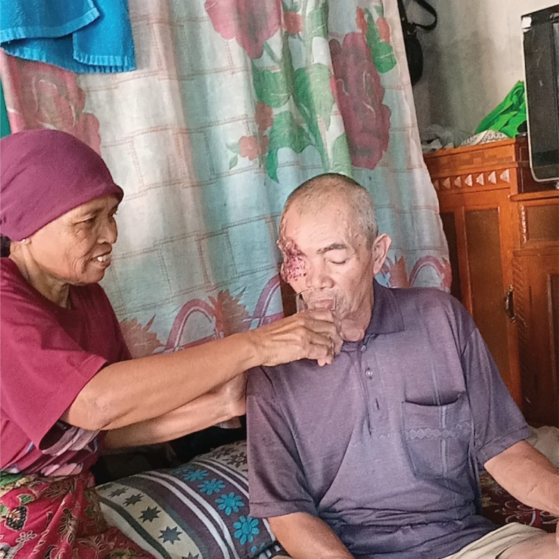 Kanker Ganas Merusak Mata dan Setengah Wajah, Bantu Pak Koko Segera Jalani Operasi