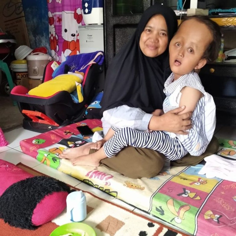 ANAK PENJUAL MAKARONI JALANAN, TAK MAMPU OPERASI CINDY HIDROSEPALUS