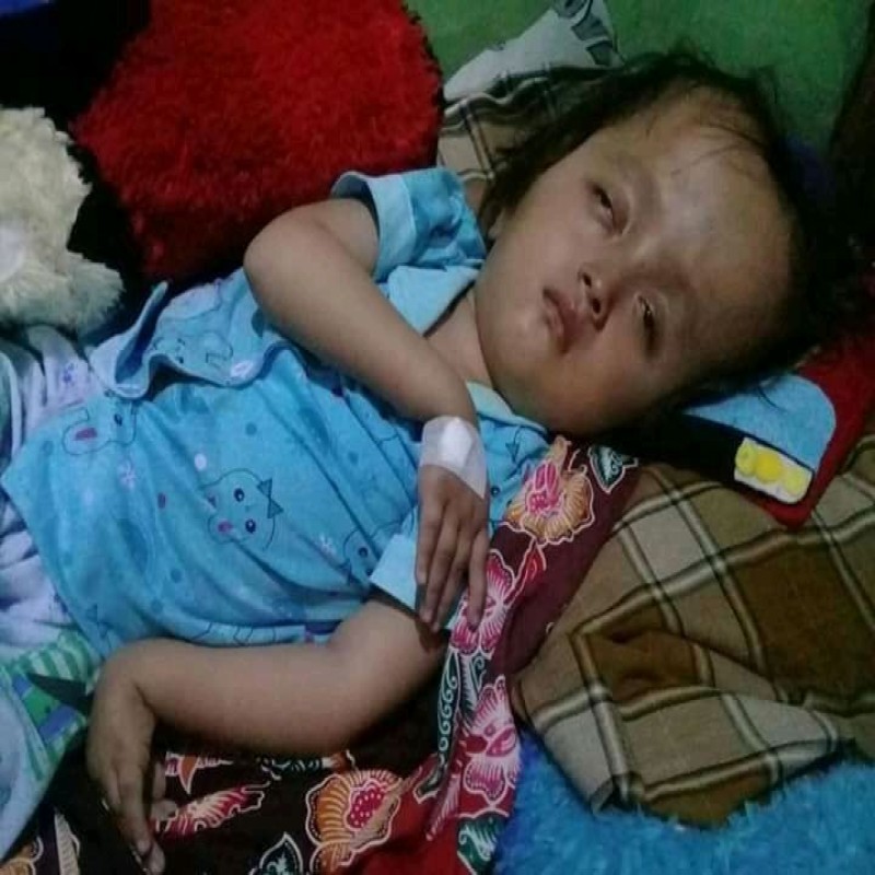 ANAK PENJUAL MAKARONI JALANAN, TAK MAMPU OPERASI CINDY HIDROSEPALUS
