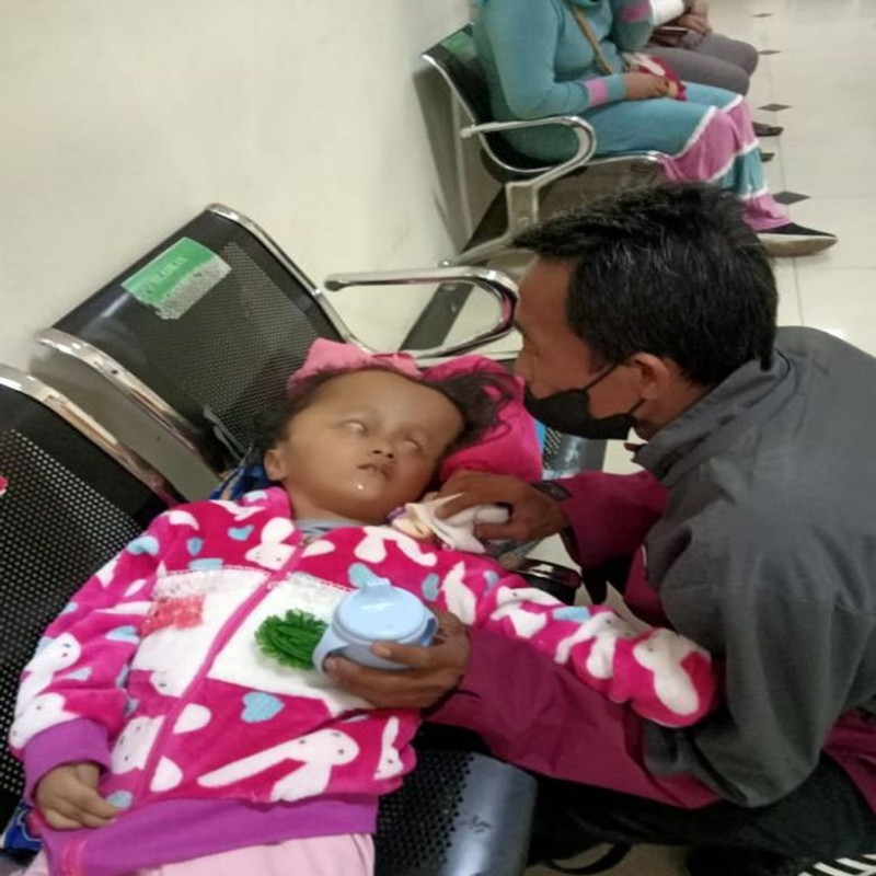 ANAK PENJUAL MAKARONI JALANAN, TAK MAMPU OPERASI CINDY HIDROSEPALUS