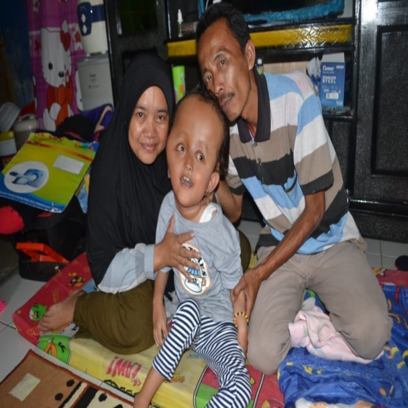 ANAK PENJUAL MAKARONI JALANAN, TAK MAMPU OPERASI CINDY HIDROSEPALUS