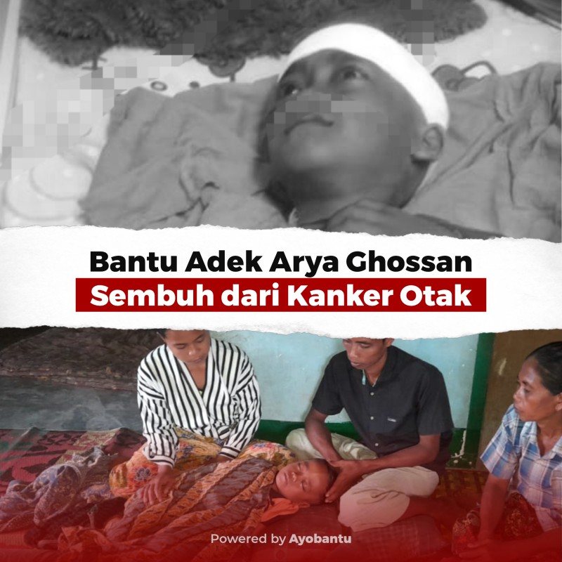 Bantu Adek Arya Ghossan Sembuh dari Kangker Otak