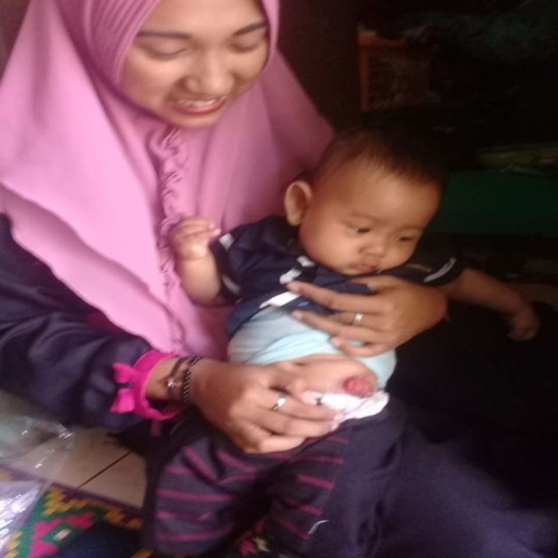 USUS HAMPIR KELUAR BAYI ADLI BUTUH SEGERA OPERSI