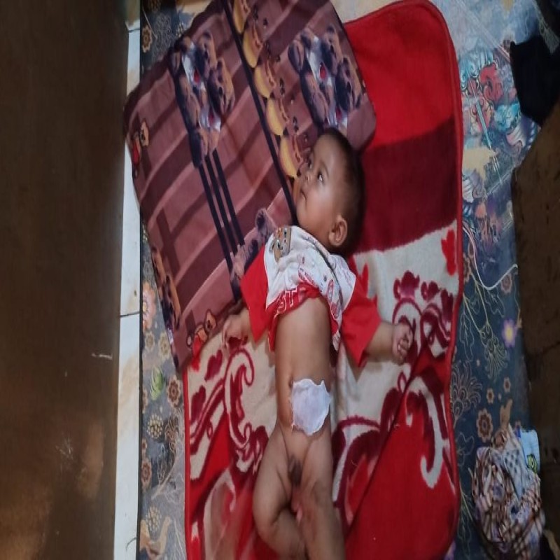 USUS HAMPIR KELUAR BAYI ADLI BUTUH SEGERA OPERSI