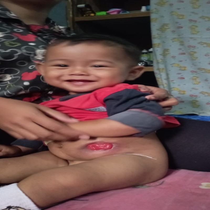 USUS HAMPIR KELUAR BAYI ADLI BUTUH SEGERA OPERSI