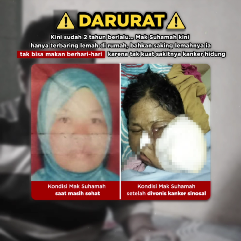 Bantu Mak Suhamah berjuang melawan kanker stadium lanjut