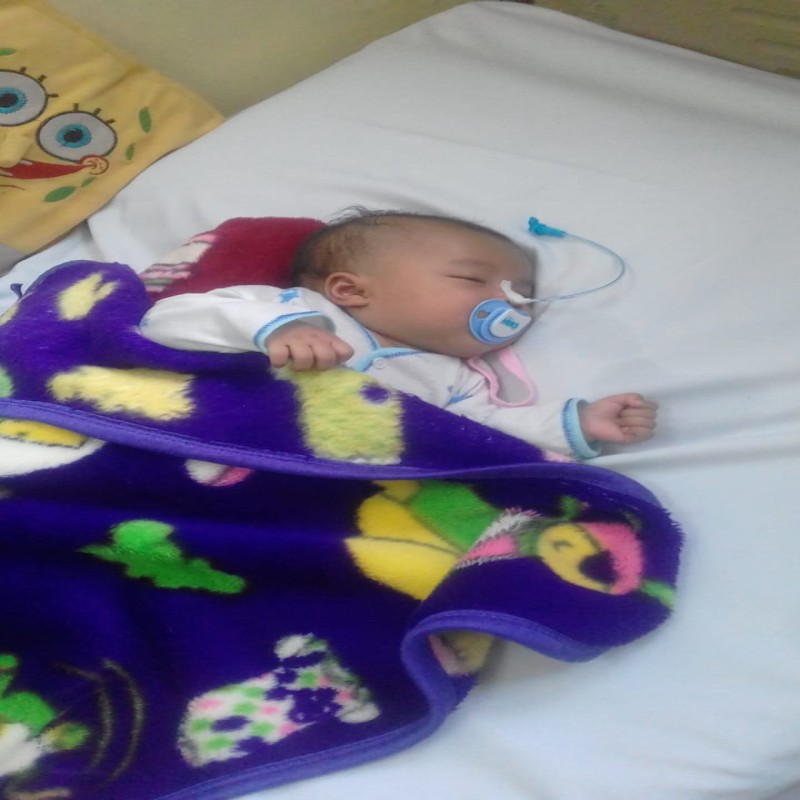 BAYI SHAIMA IDAP TUMOR DI BOKONG, SHAIMA PERLU OPERASI
