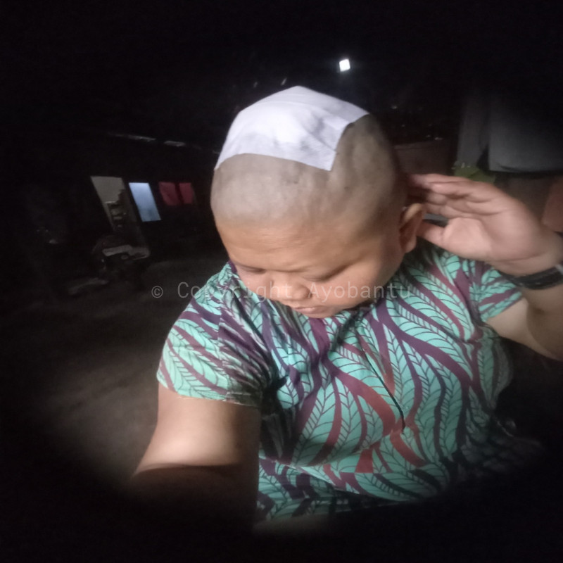 Bantu saya oprasi pengangkatan rahim dan sembuh dari 5penyakit lainnya