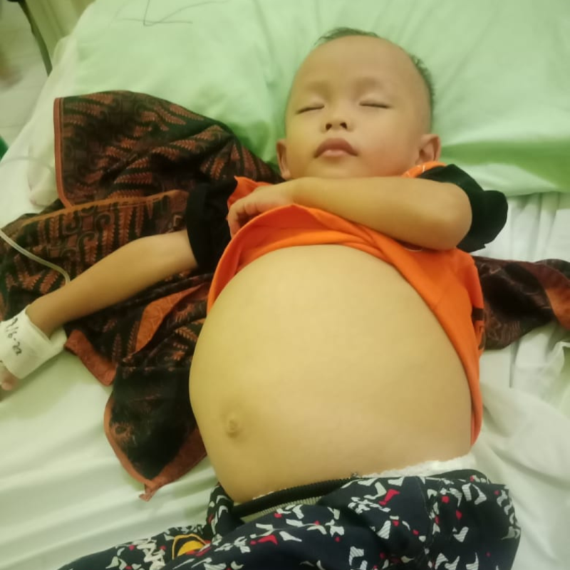 Anak Guru Honorer Berjuang Sembuh Dari Tumor Ganas