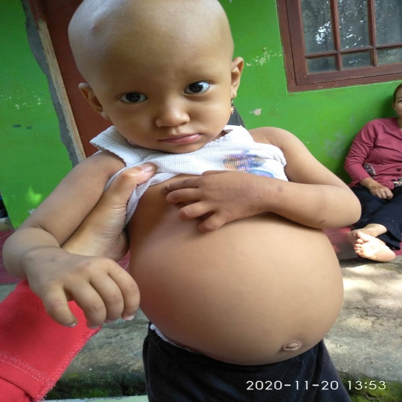 KANKER GINJAL, KEYRA 2 TH KESAKITAN !!!