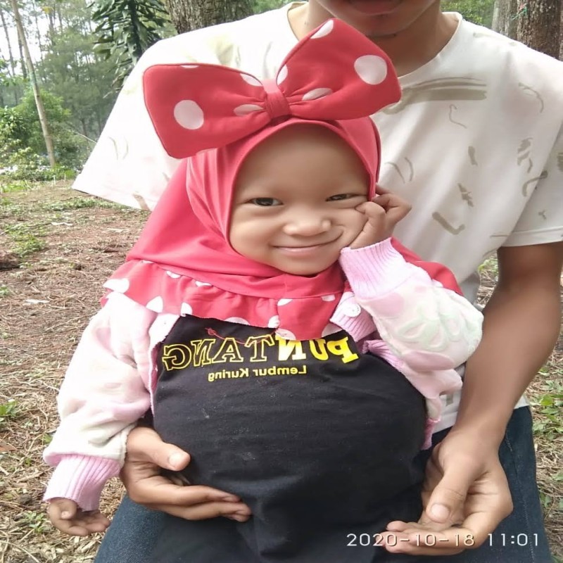 KANKER GINJAL, KEYRA 2 TH KESAKITAN !!!