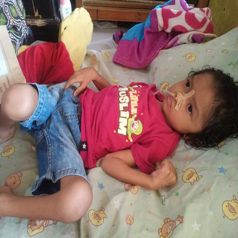 TAK BISA BERGERAK SAMA SEKALI, BANTU RAYSHA SEMBUH DARI MININGITIS