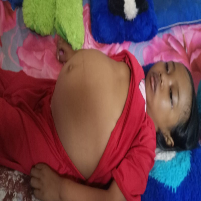 BANTU PA ASEP OBATI WINDI ANAKNYA YANG SAKIT BETA THALASSAEMIA