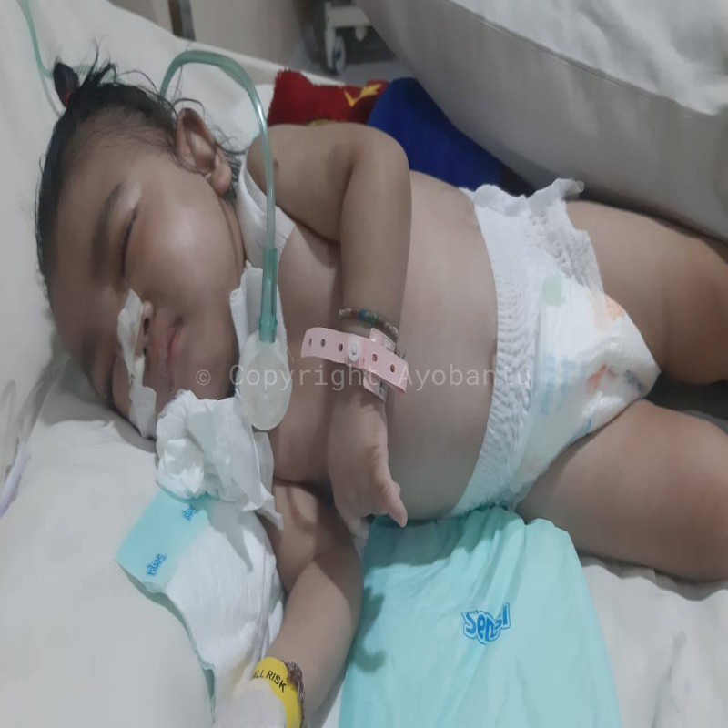 Temani Arumi Berjuang Lawan Sakit Komplikasi