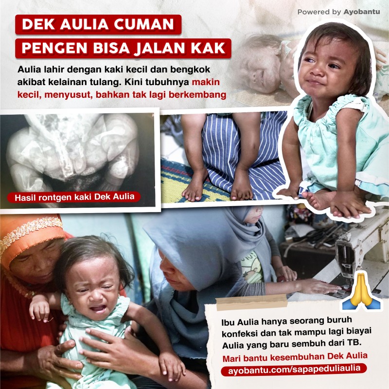 URGENT! Dik Aulia (2 Th) Sejak Lahir Kakinya Kecil dan Bengkok