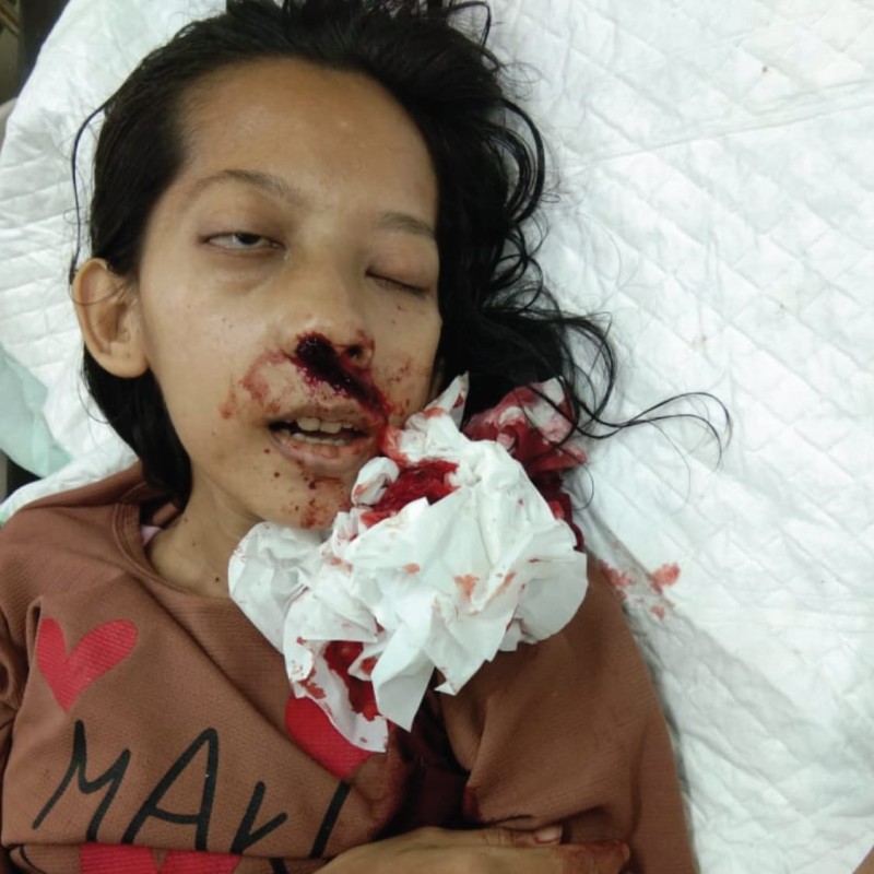 Istri Driver Ojol Ini Mengidap Tumor Ganas, Butuh Biaya Untuk Berobat Segera!