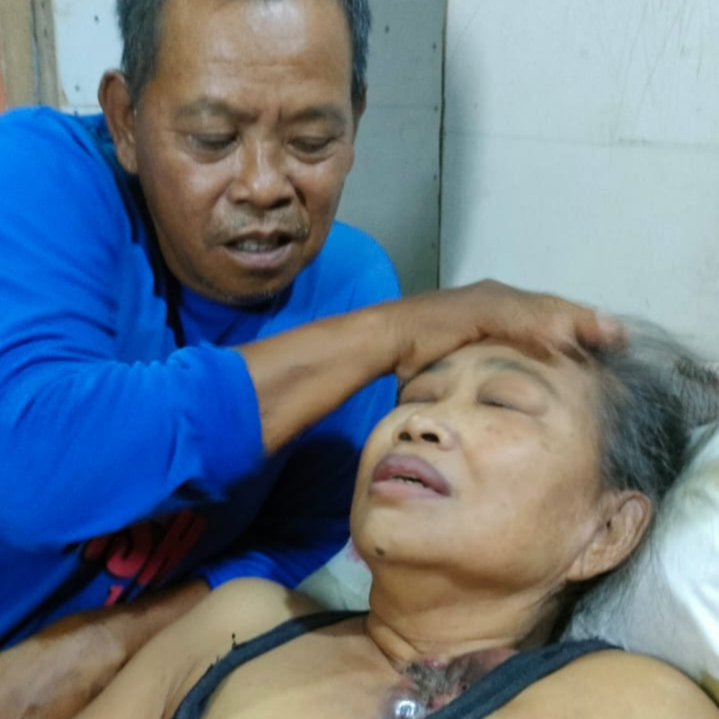 Tumor Mengganas dan Membusuk di Payudara Ibu Sri