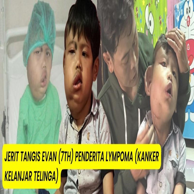 Jerit Tangis Evan (7Th) Pengidap Kanker Lympoma Yang Terus Menggema