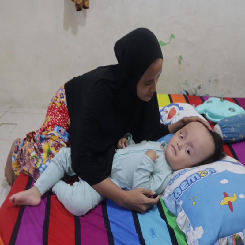 Bantu Erfira Sembuh dari Penyakitnya Hidrosefalus