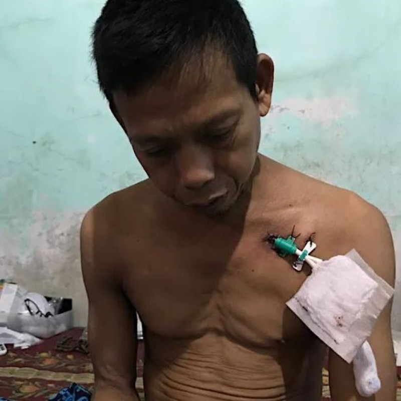 Bantu Sugiarto Sembuh dari Gagal Ginjal Stadium 5