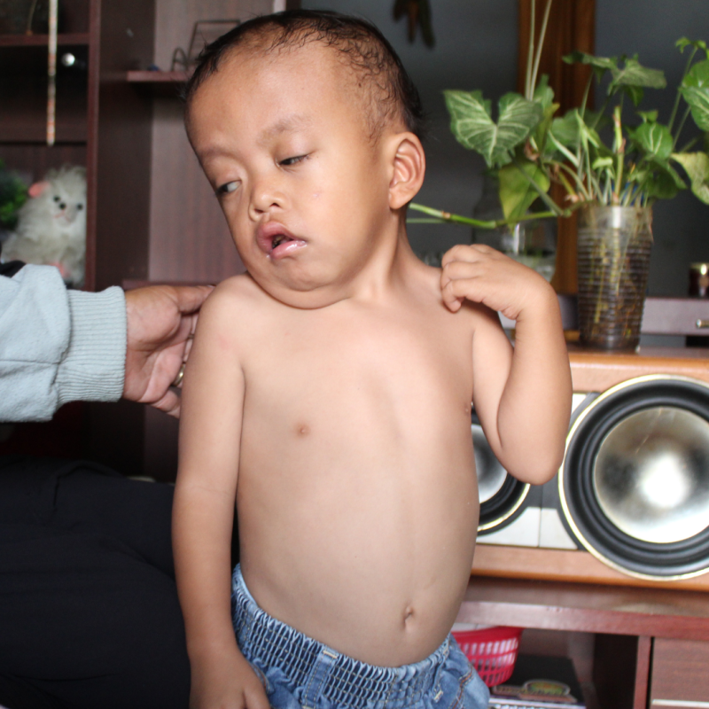 Dek Zainul, Anak Yatim Yang idap Kelaian Jantung Butuh Biaya Berobat