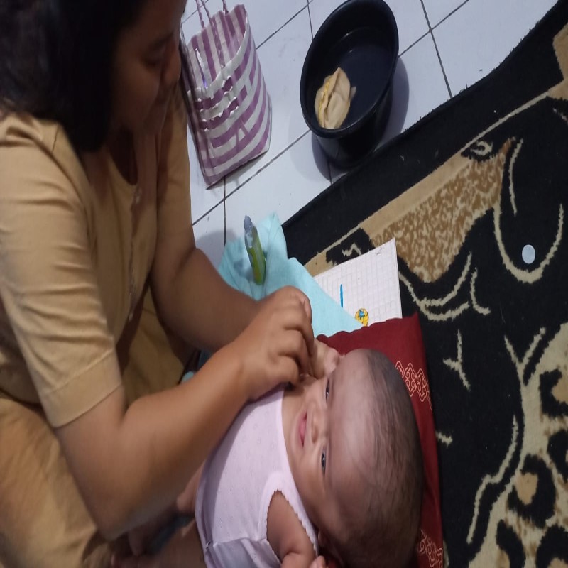 BANTU KAYLA, BAYI BU DESI IDAP HYDROCEPHALUS