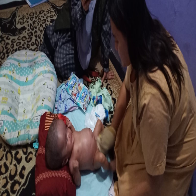 BANTU KAYLA, BAYI BU DESI IDAP HYDROCEPHALUS